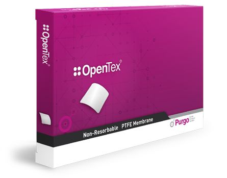 Opentex