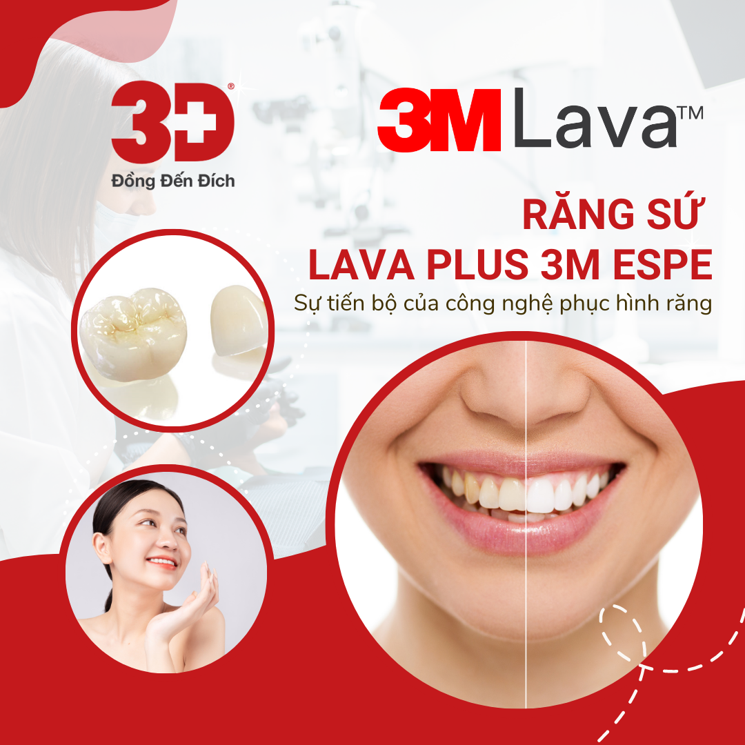 text: răng sứ lava plus 3m espe